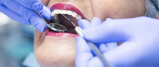 Best Emergency Gum Treatment in Carlyle, IL
